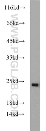 RAB7A Antibody in Western Blot (WB)