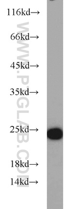 RAB7A Antibody in Western Blot (WB)