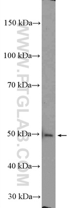 ESR2 Beta-6 Antibody in Western Blot (WB)