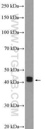 ESR2 Beta-6 Antibody in Western Blot (WB)