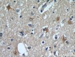 VGLUT1 Antibody in Immunohistochemistry (Paraffin) (IHC (P))