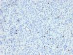 Perforin (Pore Forming Protein) (Apoptosis Marker) Antibody in Immunohistochemistry (Paraffin) (IHC (P))