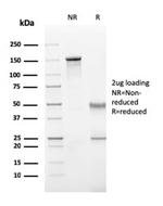 Perforin-1 (Pore Forming Protein) (Apoptosis Marker) Antibody in SDS-PAGE (SDS-PAGE)