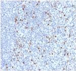 Perforin-1 (Pore Forming Protein) (Apoptosis Marker) Antibody in Immunohistochemistry (Paraffin) (IHC (P))