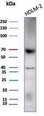 Perforin-1 (Pore Forming Protein) (Apoptosis Marker) Antibody in Western Blot (WB)