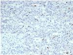 Perforin-1 (Pore Forming Protein) (Apoptosis Marker) Antibody in Immunohistochemistry (Paraffin) (IHC (P))