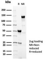 Perforin-1 (Pore Forming Protein) (Apoptosis Marker) Antibody in SDS-PAGE (SDS-PAGE)