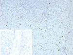 Perforin-1 (Pore Forming Protein) (Apoptosis Marker) Antibody in Immunohistochemistry (Paraffin) (IHC (P))