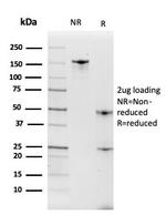 Intelectin 1/Omentin Antibody in SDS-PAGE (SDS-PAGE)