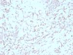 Kindlin-1/KIND1 Antibody in Immunohistochemistry (Paraffin) (IHC (P))