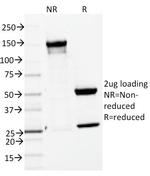 ENAH/MENA (Actin Regulator) Antibody in SDS-PAGE (SDS-PAGE)