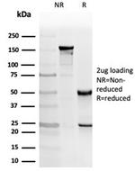 Protein Kinase C iota/lambda/PRKCI Antibody in SDS-PAGE (SDS-PAGE)