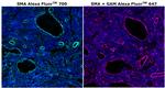 Alpha-Smooth Muscle Actin Antibody in Immunohistochemistry (Paraffin) (IHC (P))