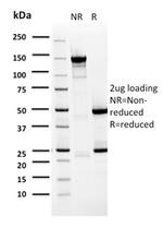 BARX1 Antibody in SDS-PAGE (SDS-PAGE)