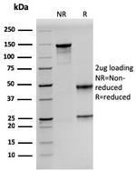 Prolactin Antibody in SDS-PAGE (SDS-PAGE)