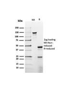 Prolactin (Pituitary Tumor Marker) Antibody in SDS-PAGE (SDS-PAGE)