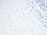 Prolactin (Pituitary Tumor Marker) Antibody in Immunohistochemistry (Paraffin) (IHC (P))