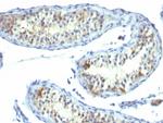 Prolactin Receptor (hPRL Receptor) Antibody in Immunohistochemistry (Paraffin) (IHC (P))