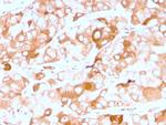 Prolactin Receptor (hPRL Receptor) Antibody in Immunohistochemistry (Paraffin) (IHC (P))