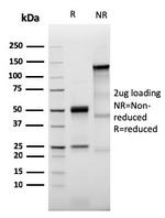 Prolactin Receptor (hPRL Receptor) Antibody in SDS-PAGE (SDS-PAGE)