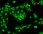 CaMKII Antibody in Immunocytochemistry (ICC/IF)