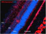 Nitrotyrosine Antibody in Immunohistochemistry (IHC)