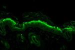 Nitrotyrosine Antibody in Immunohistochemistry (Paraffin) (IHC (P))