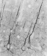 PSD95 Antibody in Immunohistochemistry (Paraffin) (IHC (P))