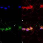 NR2B Glutamate Receptor Antibody in Immunocytochemistry (ICC/IF)