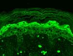 NR2B Glutamate Receptor Antibody in Immunohistochemistry (Paraffin) (IHC (P))