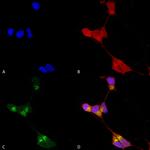 Delta GABA-A Receptor Antibody in Immunocytochemistry (ICC/IF)