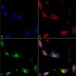 Shank2 Antibody in Immunocytochemistry (ICC/IF)