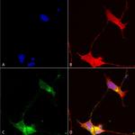 pan-Shank Antibody in Immunocytochemistry (ICC/IF)