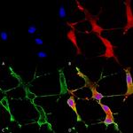 Shank1 Antibody in Immunocytochemistry (ICC/IF)