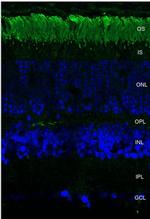 Rhodopsin Antibody in Immunohistochemistry (Paraffin) (IHC (P))