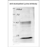 Acetylated Lysine Antibody in Western Blot (WB)