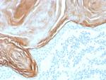 KLK7 (Kallikrein Related Peptidase 7) Antibody in Immunohistochemistry (Paraffin) (IHC (P))