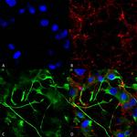 VAChT Transporter Antibody in Immunocytochemistry (ICC/IF)