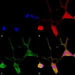 VGlut1 Transporter Antibody in Immunocytochemistry (ICC/IF)