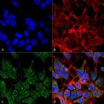 VGlut2 Transporter Antibody in Immunocytochemistry (ICC/IF)