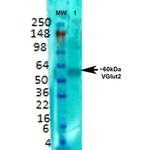 VGlut2 Transporter Antibody in Western Blot (WB)