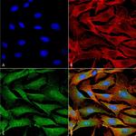 Copper-Transporting ATPase1 Antibody in Immunocytochemistry (ICC/IF)