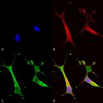 Copper-Transporting ATPase2 Antibody in Immunocytochemistry (ICC/IF)