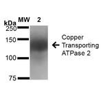 Copper-Transporting ATPase2 Antibody in Western Blot (WB)