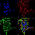 GABA (B)R2 Antibody in Immunocytochemistry (ICC/IF)