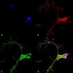 GABA (B)R1 Antibody in Immunocytochemistry (ICC/IF)