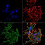 GABA (B)R1 Antibody in Immunocytochemistry (ICC/IF)