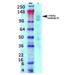 GABA (B)R1 Antibody in Western Blot (WB)