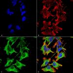 NR1 Glutamate Receptor Antibody in Immunocytochemistry (ICC/IF)