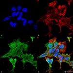 Alpha-2C Adrenergic Receptor Antibody in Immunocytochemistry (ICC/IF)